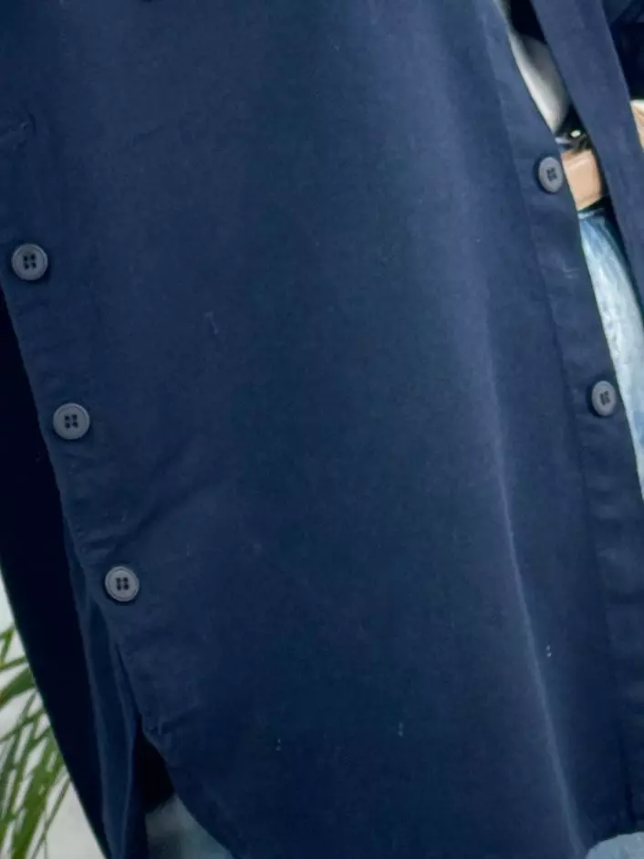 مانتو دخترانه چیچک